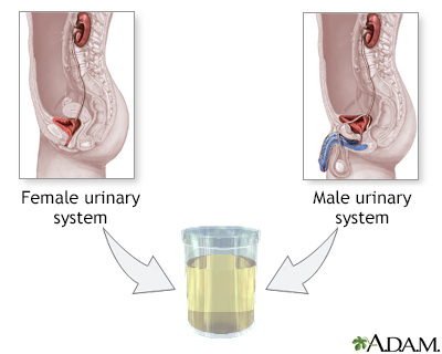 Urine sample - Illustration Thumbnail                      
