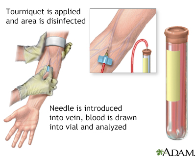 Blood test - Illustration Thumbnail                      