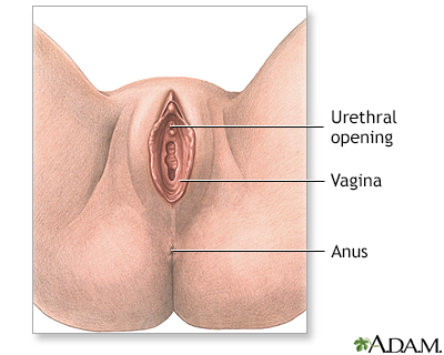 Anterior vaginal wall repair (surgical treatment of urinary incontinence) - series - Presentation Thumbnail                    