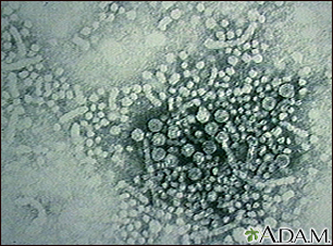 Hepatitis B virus - Illustration Thumbnail                      