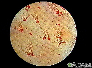 Salmonella typhi organism - Illustration Thumbnail                      