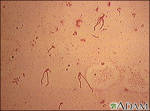 Yersinia enterocolitica organism - Illustration Thumbnail                      