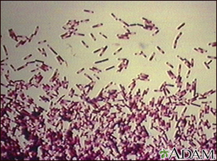 Clostridium difficile organism - Illustration Thumbnail                      