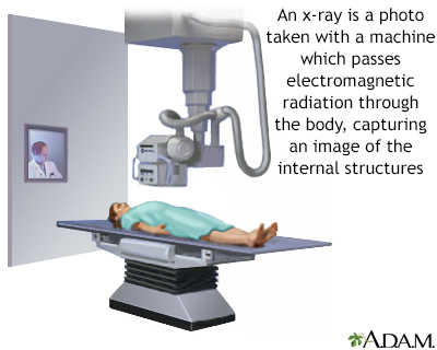 X-ray - Illustration Thumbnail                      