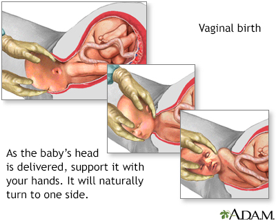 Childbirth - Illustration Thumbnail                      