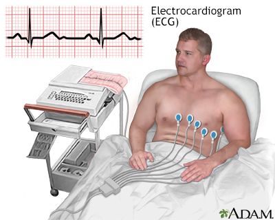 ECG - Illustration Thumbnail                      
