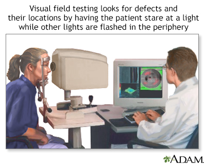 Visual field test - Illustration Thumbnail                      