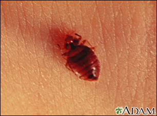 Bedbug - close-up - Illustration Thumbnail                      