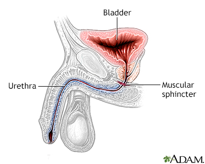 Inflatable artificial sphincter - series - Normal anatomy - Presentation Thumbnail                    