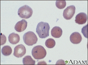 Malaria, microscopic view of cellular parasites - Illustration Thumbnail                      