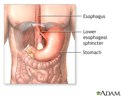 Gastroesophageal reflux - series - Presentation Thumbnail                    