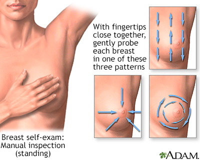 Breast self-exam - Illustration Thumbnail              