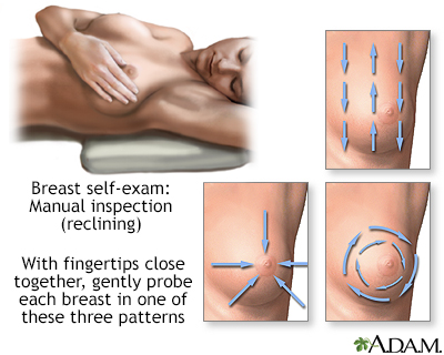 Breast self-exam - Illustration Thumbnail                      