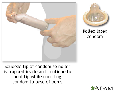The male condom - Illustration Thumbnail                      