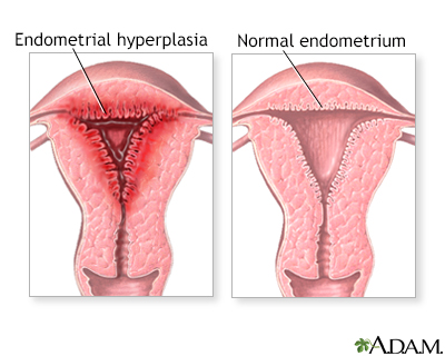 Abnormal menstrual periods - Illustration Thumbnail                      