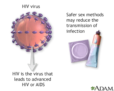 HIV - Illustration Thumbnail                      