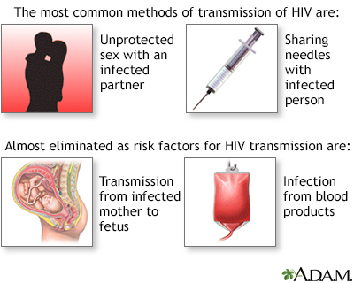 Primary HIV infection - Illustration Thumbnail                      