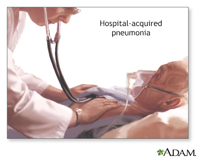 Hospital-acquired pneumonia