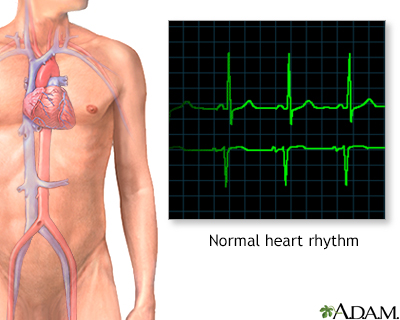 Normal heart rhythm - Illustration Thumbnail                      