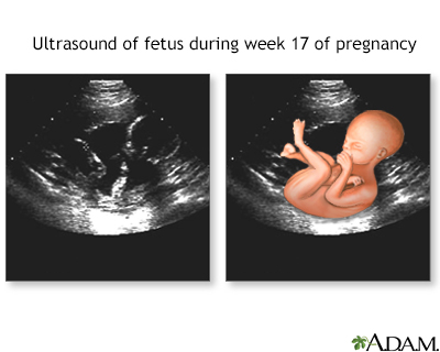 17 week ultrasound - Illustration Thumbnail                      