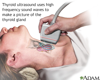 Thyroid ultrasound - Illustration Thumbnail                      
