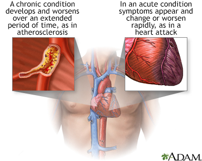 Acute vs. chronic conditions - Illustration Thumbnail                      