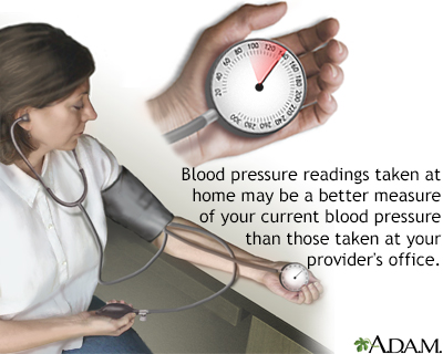 Monitoring blood pressure - Illustration Thumbnail                      