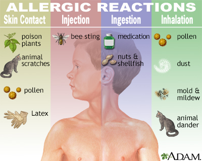 Allergic reactions - Illustration Thumbnail                      