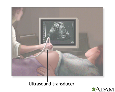 Prenatal ultrasound - series - Procedure, part 1 - Presentation Thumbnail                    