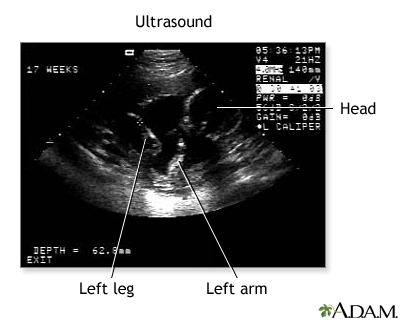 Prenatal ultrasound - series - Procedure, part 3