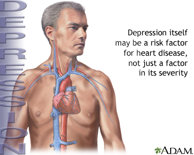 Depression and heart disease