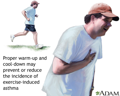 Exercise-induced asthma - Illustration Thumbnail                      