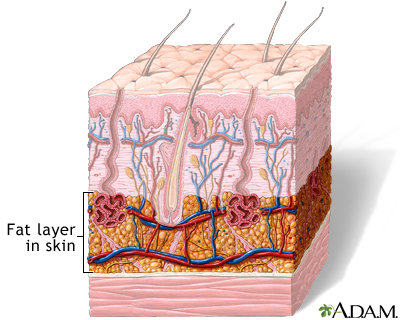 Fat layer in skin - Illustration Thumbnail                      