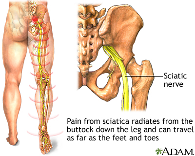 Sciatic nerve - Illustration Thumbnail                      