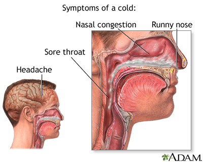 Cold symptoms - Illustration Thumbnail                      