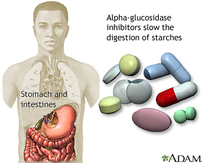 Alpha-glucosidase inhibitors - Illustration Thumbnail                      
