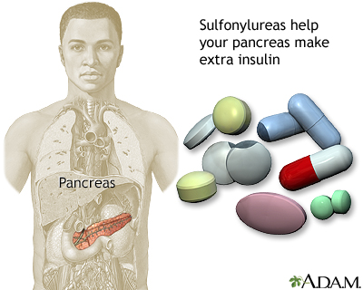 Sulfonylureas drug - Illustration Thumbnail                      