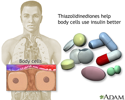 Thiazolidinediones - Illustration Thumbnail                      