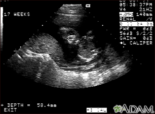 Ultrasound, normal fetus - face - Illustration Thumbnail                      