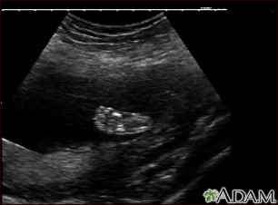 Ultrasound, normal fetus - foot - Illustration Thumbnail                      