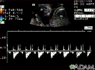 Ultrasound, normal fetus - heartbeat - Illustration Thumbnail                      