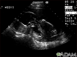 Ultrasound, normal fetus - profile view - Illustration Thumbnail                      
