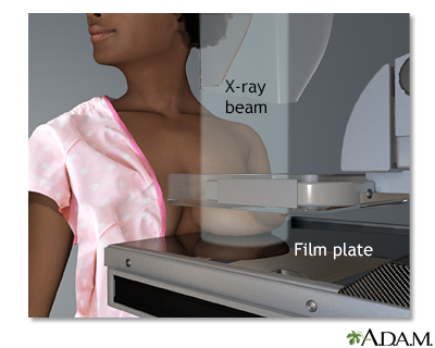 Mammogram - Illustration Thumbnail                      
