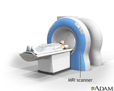 MRI scans - Illustration Thumbnail                      