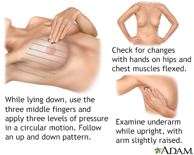 Breast self-exam - Illustration Thumbnail              