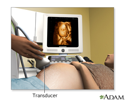 3D ultrasound - Illustration Thumbnail                      