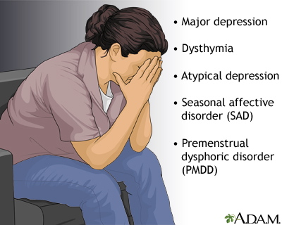 Forms of depression - Illustration Thumbnail                      