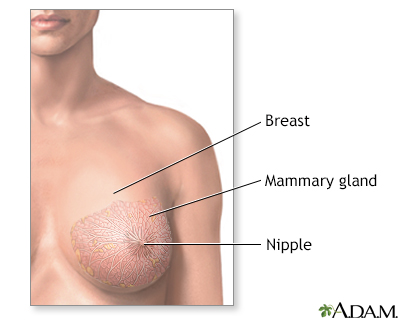 Breast lump removal  - series - Illustration Thumbnail              
