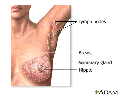 Mastectomy - series - Normal anatomy - Presentation Thumbnail                    