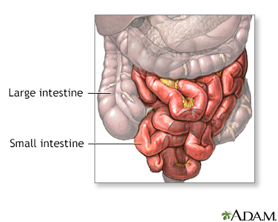 Small bowel resection - series - Presentation Thumbnail                    